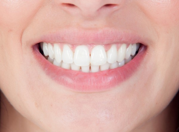Por Que Seus Dentes Estão Ficando Transparentes? Causas, Riscos e Soluções