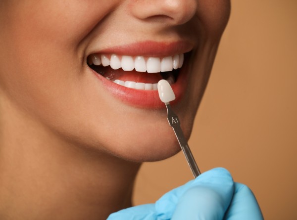 Lentes de Contato Dentais Estragam os Dentes? O Que é Verdade e O Que é Medo Sem Base